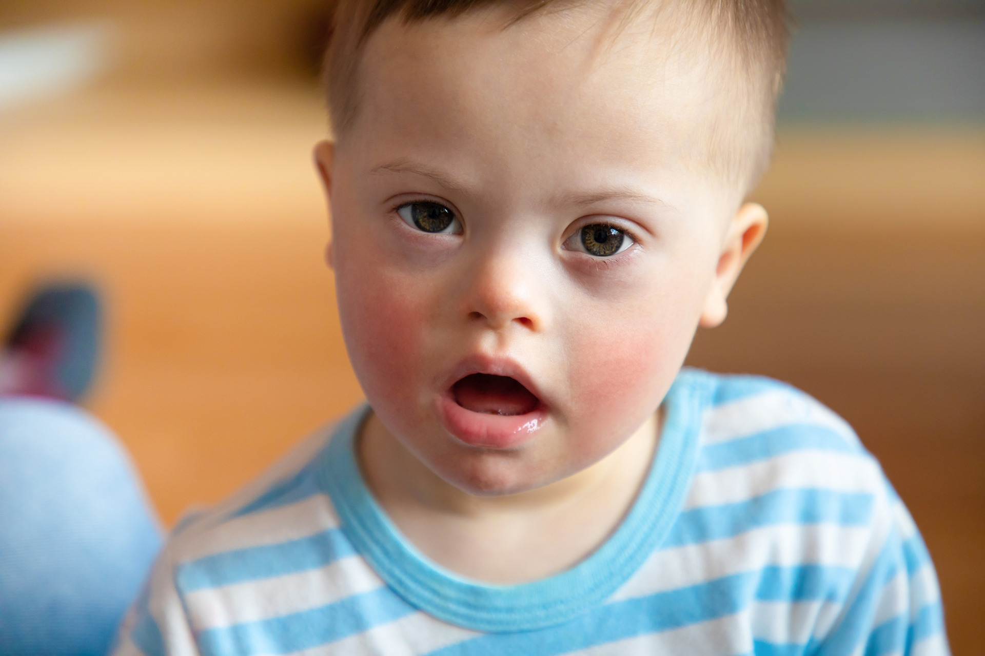 «Kinder mit Trisomie 21 brauchen langfristig eine gute Gesamtbetreuung»