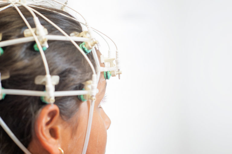 eeg neuropädiatrie